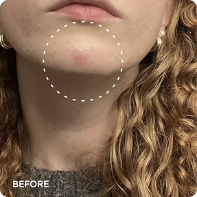 Pads Éclat Unifiant