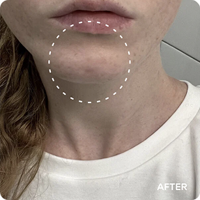 JiYu Anti-Aging Glow-Up Bundle