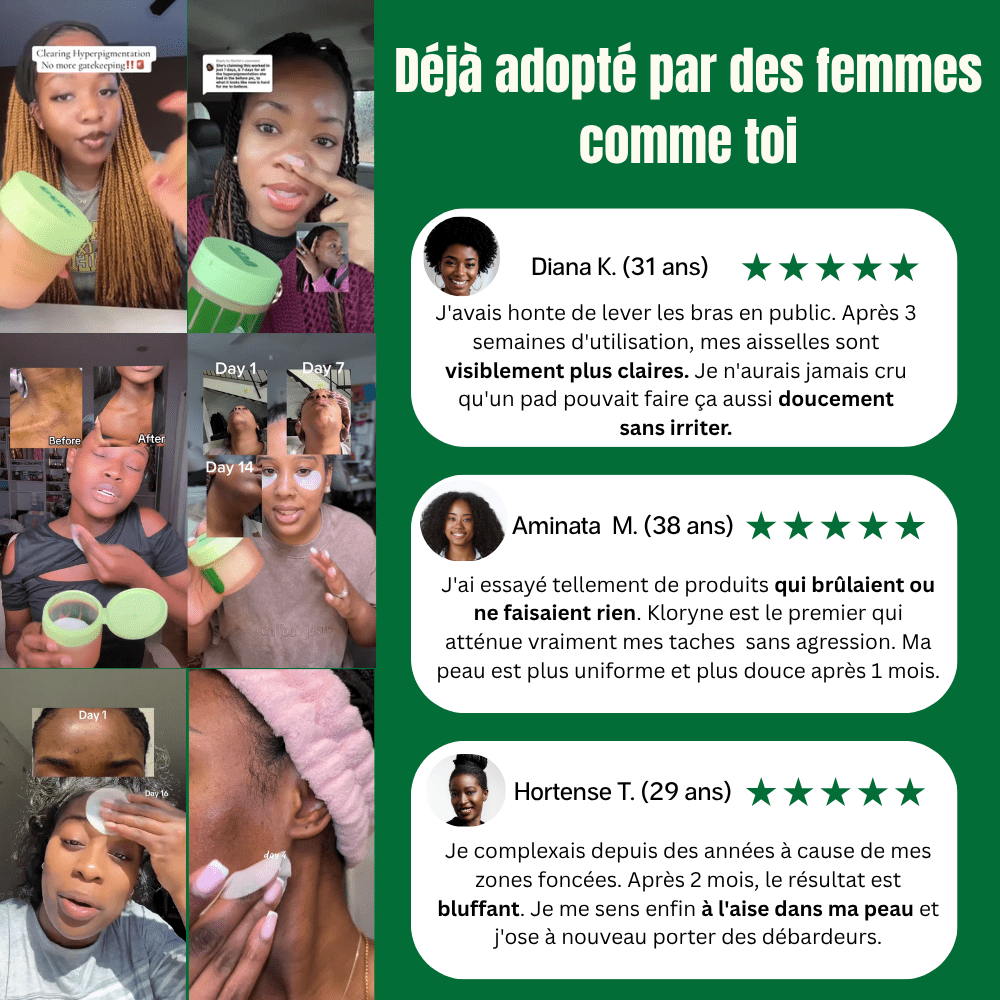 Pads Anti - Taches Noires 3 en 1 - Kloryne