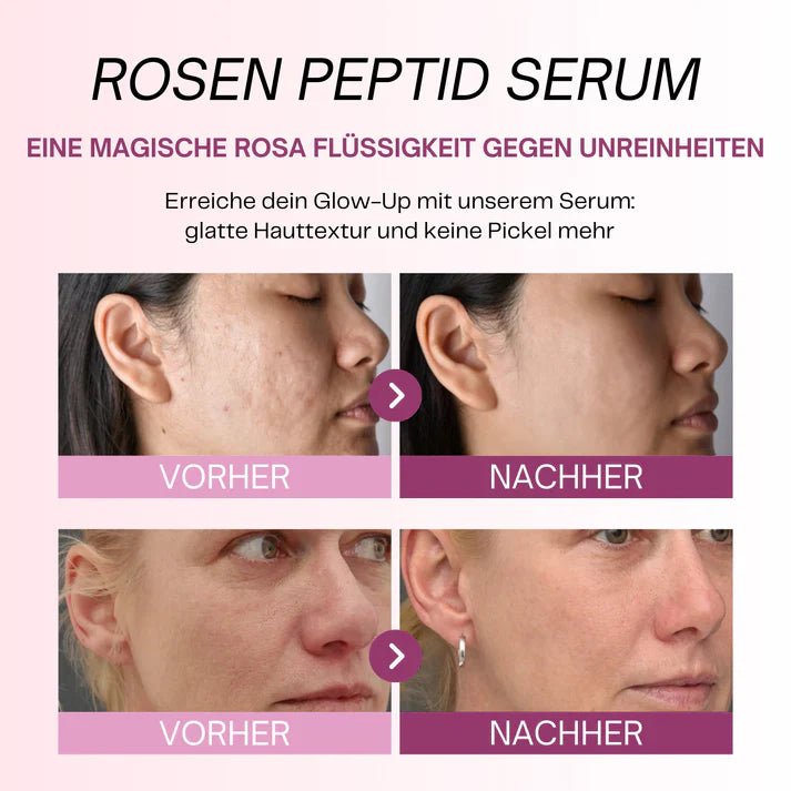 Peptid - Serum mit PDRN - Kloryne